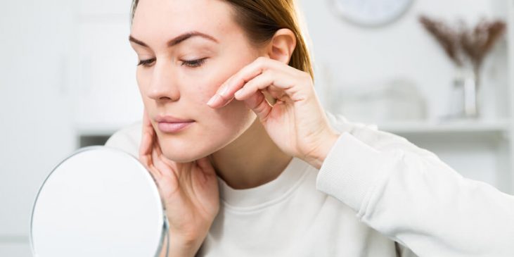 Woman touching winter skin problems on face