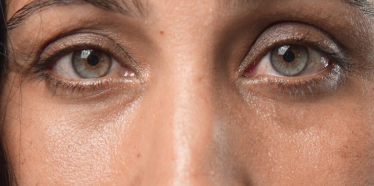 woman tired eyes