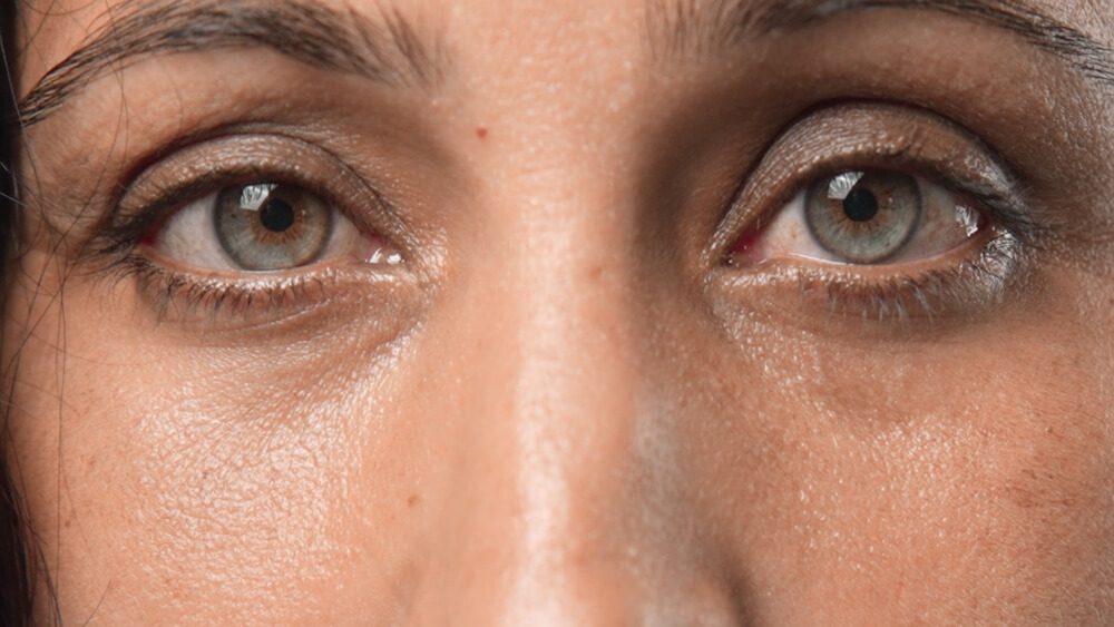 woman tired eyes