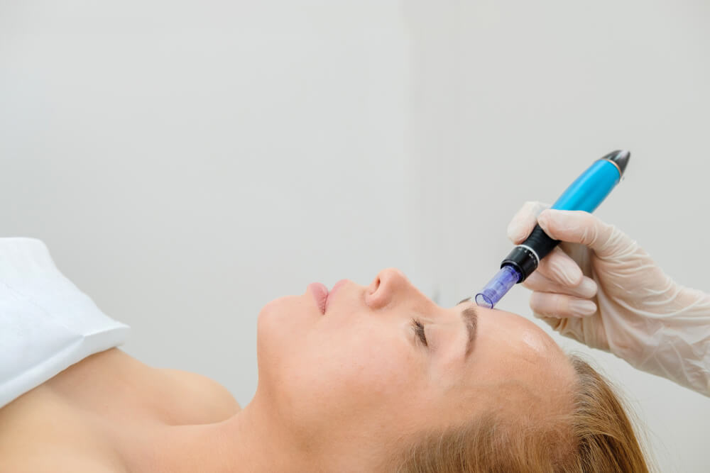 Woman receiving microneedling treatment