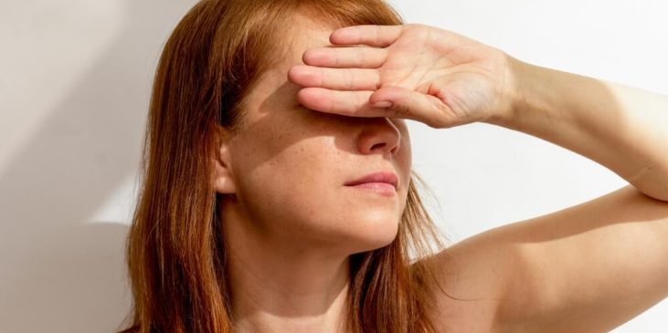 woman sun damage